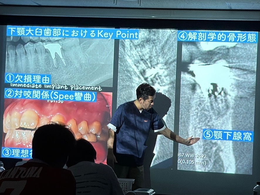 OSSTEM MASTER COURSEで下顎大臼歯部のインプラント治療について講義する橋口隼人